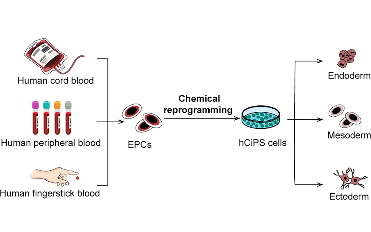 Turning a Drop of Blood into Stem Cells: A Leap Forward in Regenerative Medicine Turning a Drop of Blood into Stem Cells: A Leap Forward in Regenerative Medicine